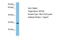 RPP38 Rabbit anti-Human, Polyclonal, Novus Biologicals 0.1ml; Unconjugated:Antibodies,